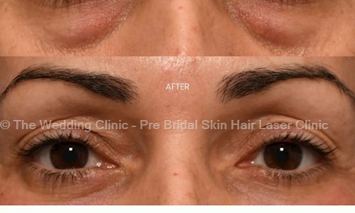 The Wedding Clinic - Pre Bridal Skin Hair Laser Clinic in Koregaon Park, Pune - 411001