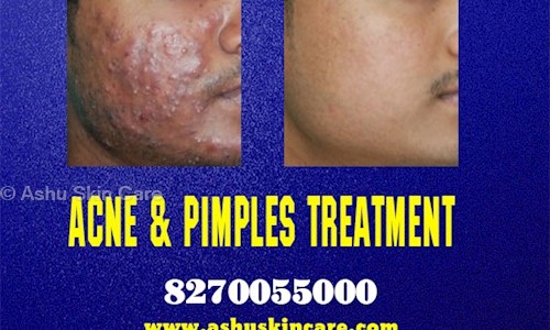 Ashu Skin Care in Jayadev Vihar, Bhubaneswar - 751013