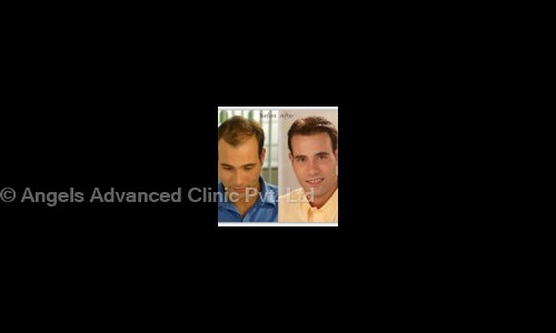Angels Advanced Clinic Pvt. Ltd. in Panjagutta, Hyderabad - 500082