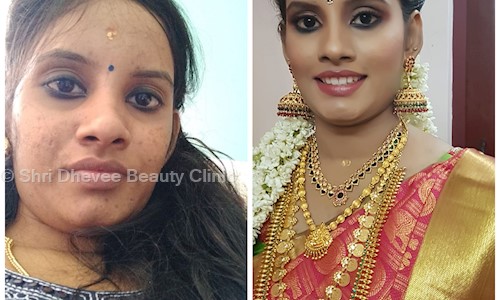 Shri Dhevee Beauty Clinic in Saibaba Colony, Coimbatore - 641011