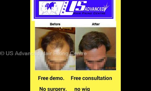 US Advanced Hair Fixing Centre in Nungambakkam, Chennai - 600034