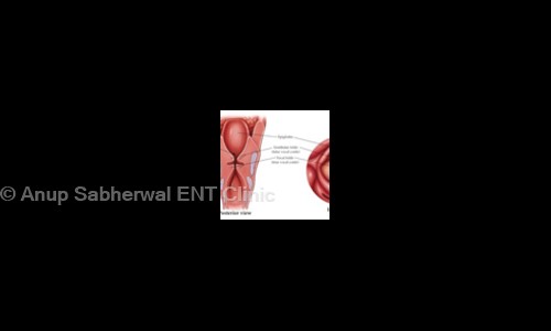 Anup Sabherwal ENT Clinic in Malviya Nagar, Delhi - 110017