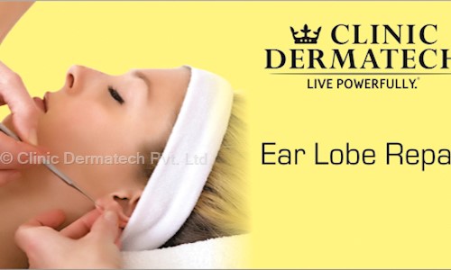 Clinic Dermatech Pvt. Ltd. in South Extension Part I, Delhi - 110049