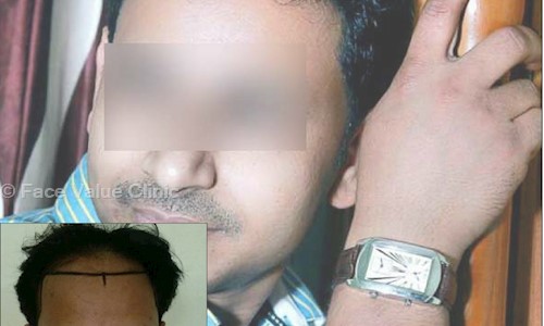 Face Value Clinic in Mira Road, Mumbai - 401107
