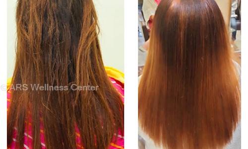 ARS Wellness Center in Ratu Road, Ranchi - 834001