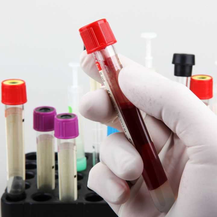 Lab view 12