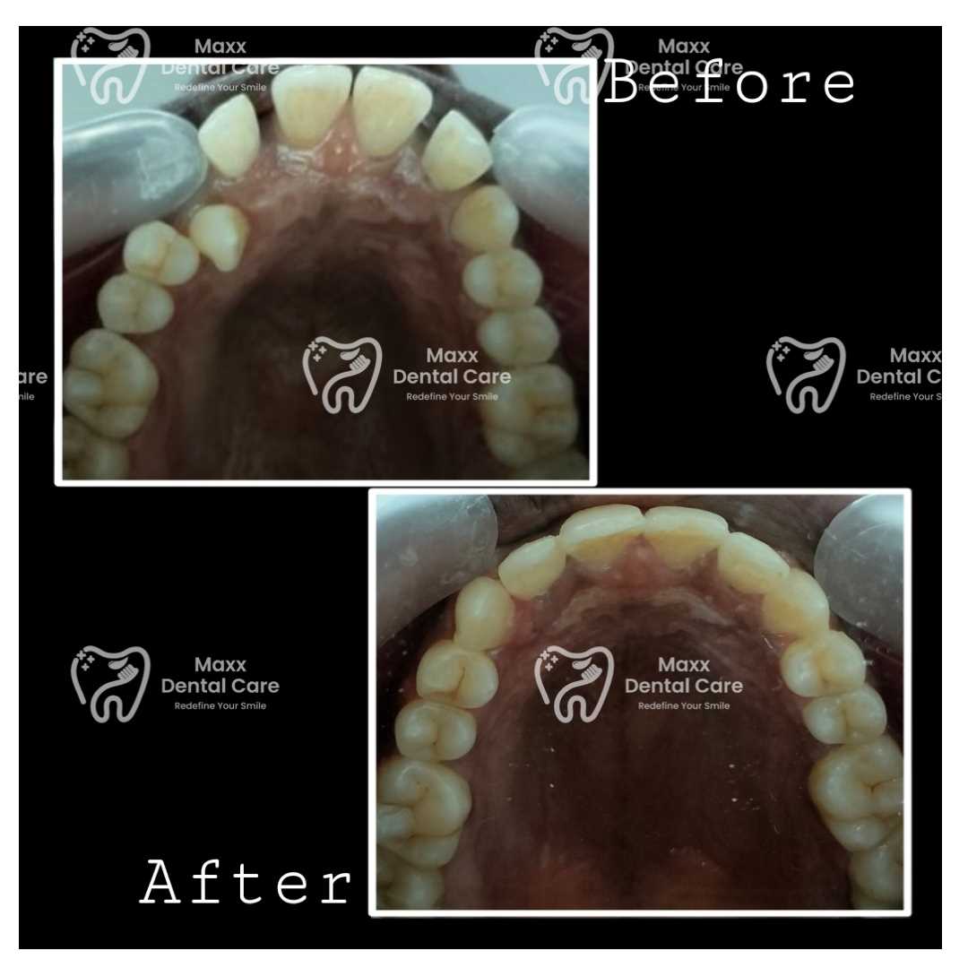 MAXX DENTAL CARE Best Dental Clinic in Velachery in 100 Feet Taramani Link Road, Velachery