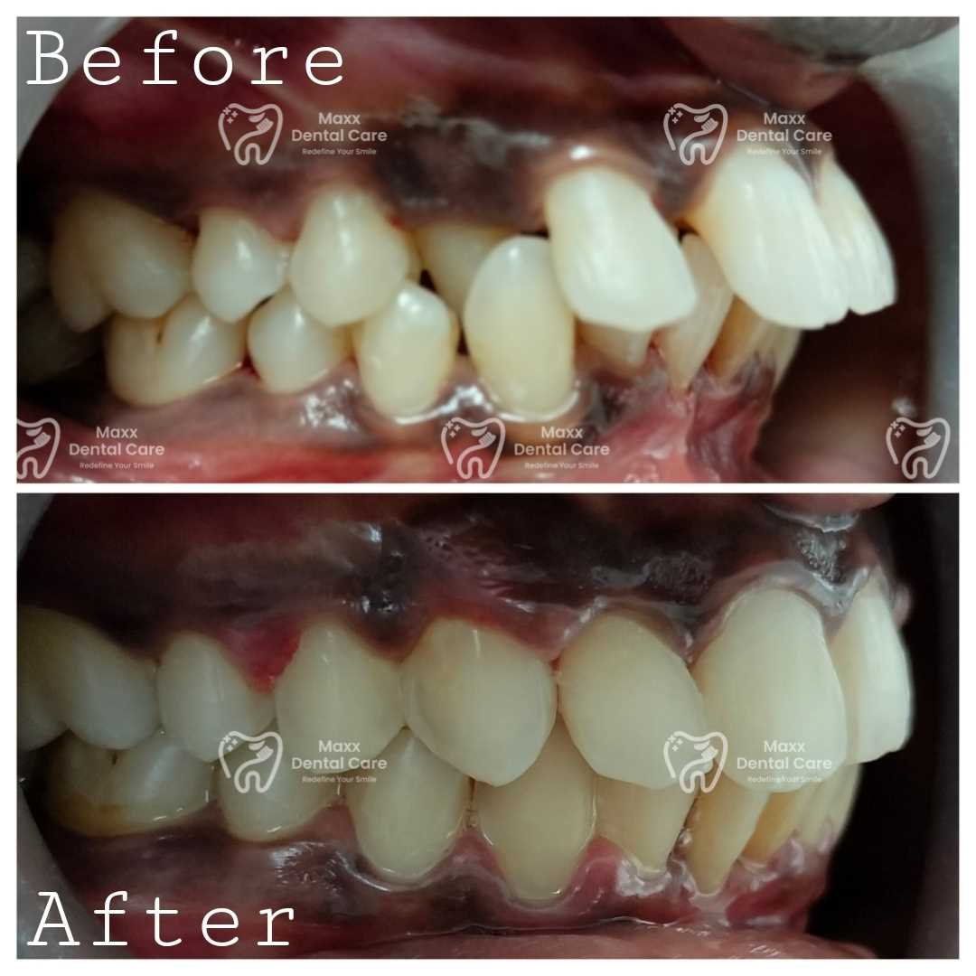 MAXX DENTAL CARE in 100 Feet Taramani Link Road, Velachery