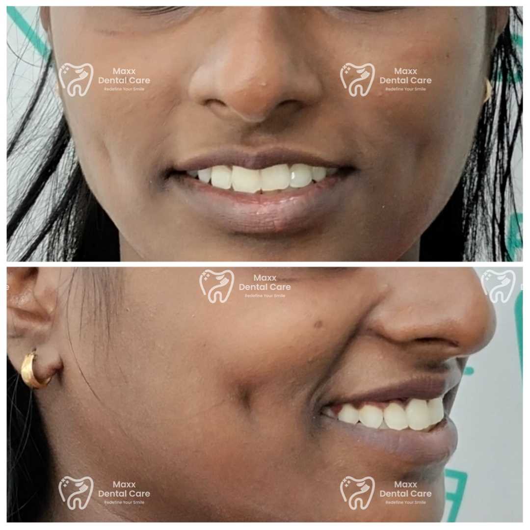 MAXX DENTAL CARE in 100 Feet Taramani Link Road, Velachery