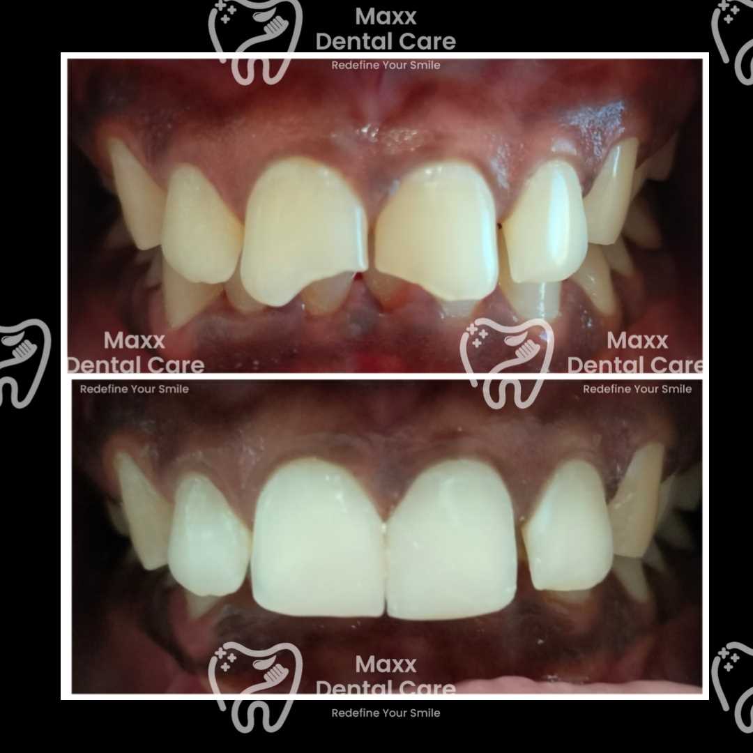 MAXX DENTAL CARE in 100 Feet Taramani Link Road, Velachery