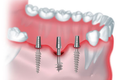 Logo of COSMODENT INDIA - INVISALIGN l DENTAL IMPLANTS l SMILE DESIGN l VENEERS l ORTHO BRACES l LASER RCTs l 3D SCANS and MUCH MORE